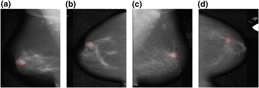 An Overview of Mammary Gland Molybdenum Target X-Ray Inspection